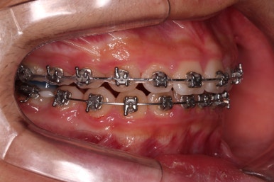 부산청소년교정