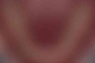 부산주걱턱교정