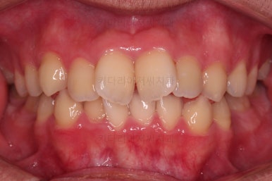 부산교정치과추천