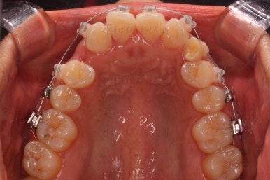 연산동교정치과