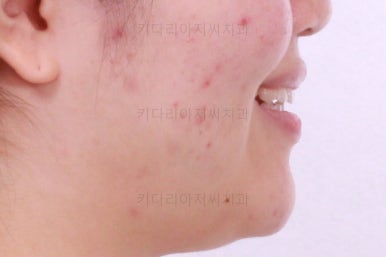 부산치아교정치과