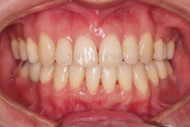 부산재교정치과