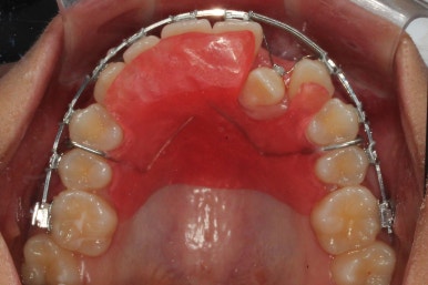부산연산동청소년교정