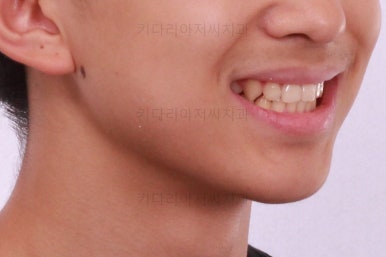 부산교정치과추천