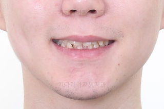 부산교정치과
