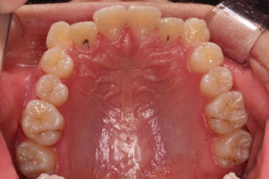 연산동교정치과