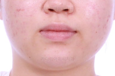부산치아교정치과