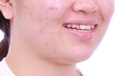 부산치아교정치과