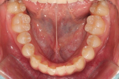 부산연산동청소년교정