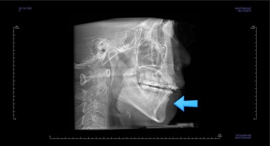 부산연산동교정치과