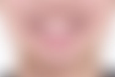 부산치아교정전문의