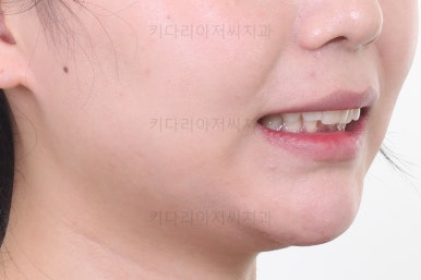 부산교정치료
