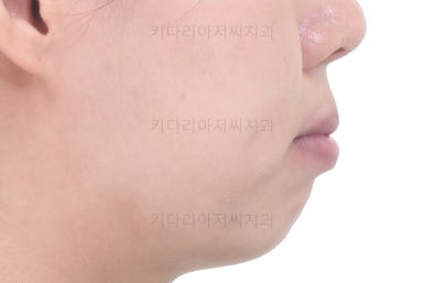 부산치아교정잘하는치과