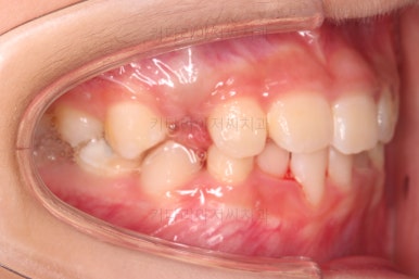 부산어린이교정