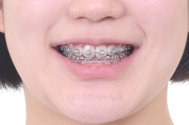 사직동교정치과