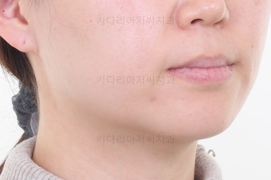 부산연산동치과