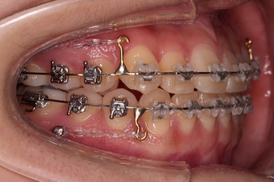 연산동교정치과