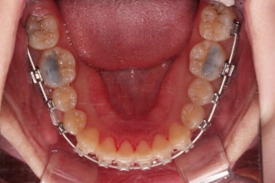 연산동교정치과