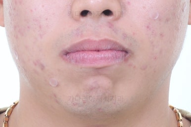 부산교정치과