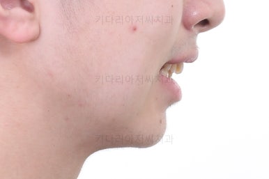 부산교정치과추천