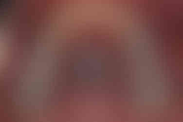 부산치아교정잘하는곳