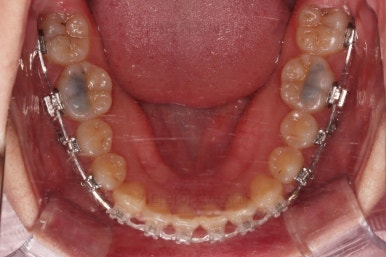 연산동교정치과