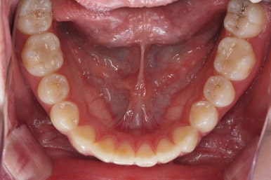 부산치아교정잘하는곳