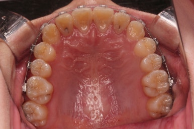 연산동교정치과