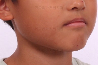 부산어린이교정