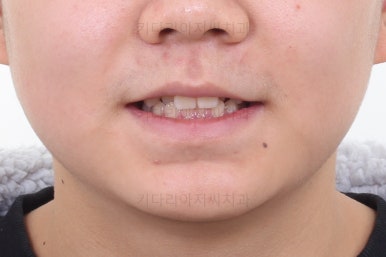 부산청소년교정