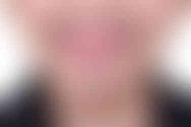 부산사각턱보톡스