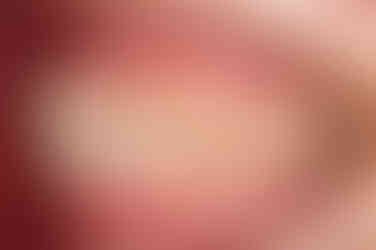 부산치아교정잘하는곳