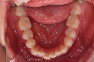 부산교정잘하는치과