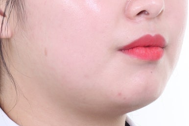 부산치아교정치과