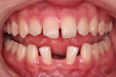 부산교정치과추천