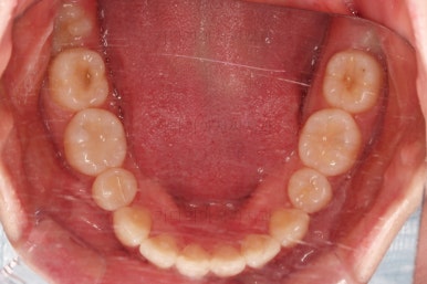 부산교정전문의