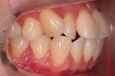 부산교정전문의