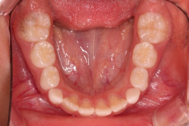 부산어린이교정