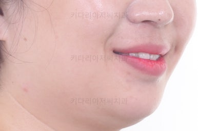 부산교정치과
