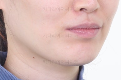 부산교정치과