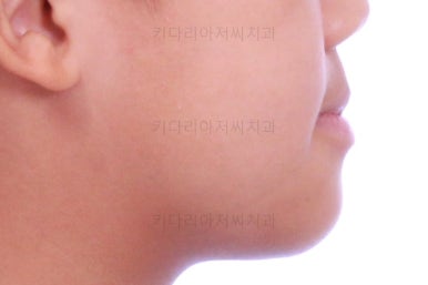 부산어린이교정