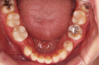 부산인비절라인