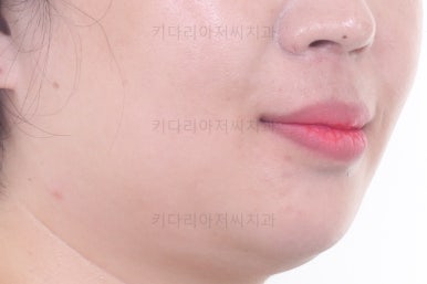 부산교정치과