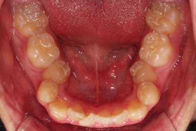 부산교정치과추천