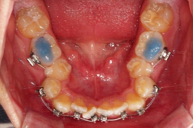 부산교정치과추천