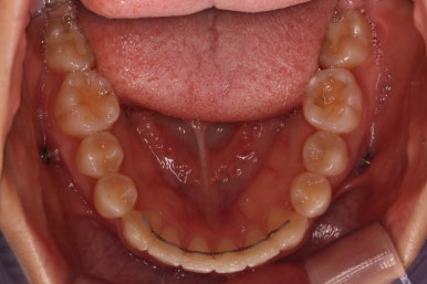 연산동교정치과