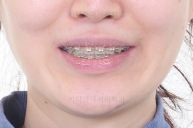 부산교정치과