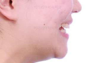 부산교정전문의