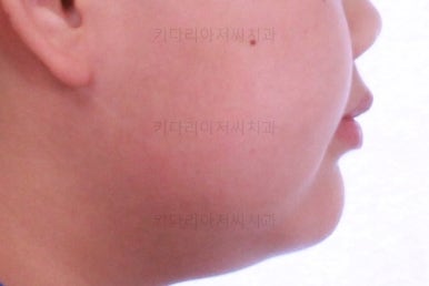부산교정치과추천