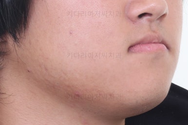 연산동교정
